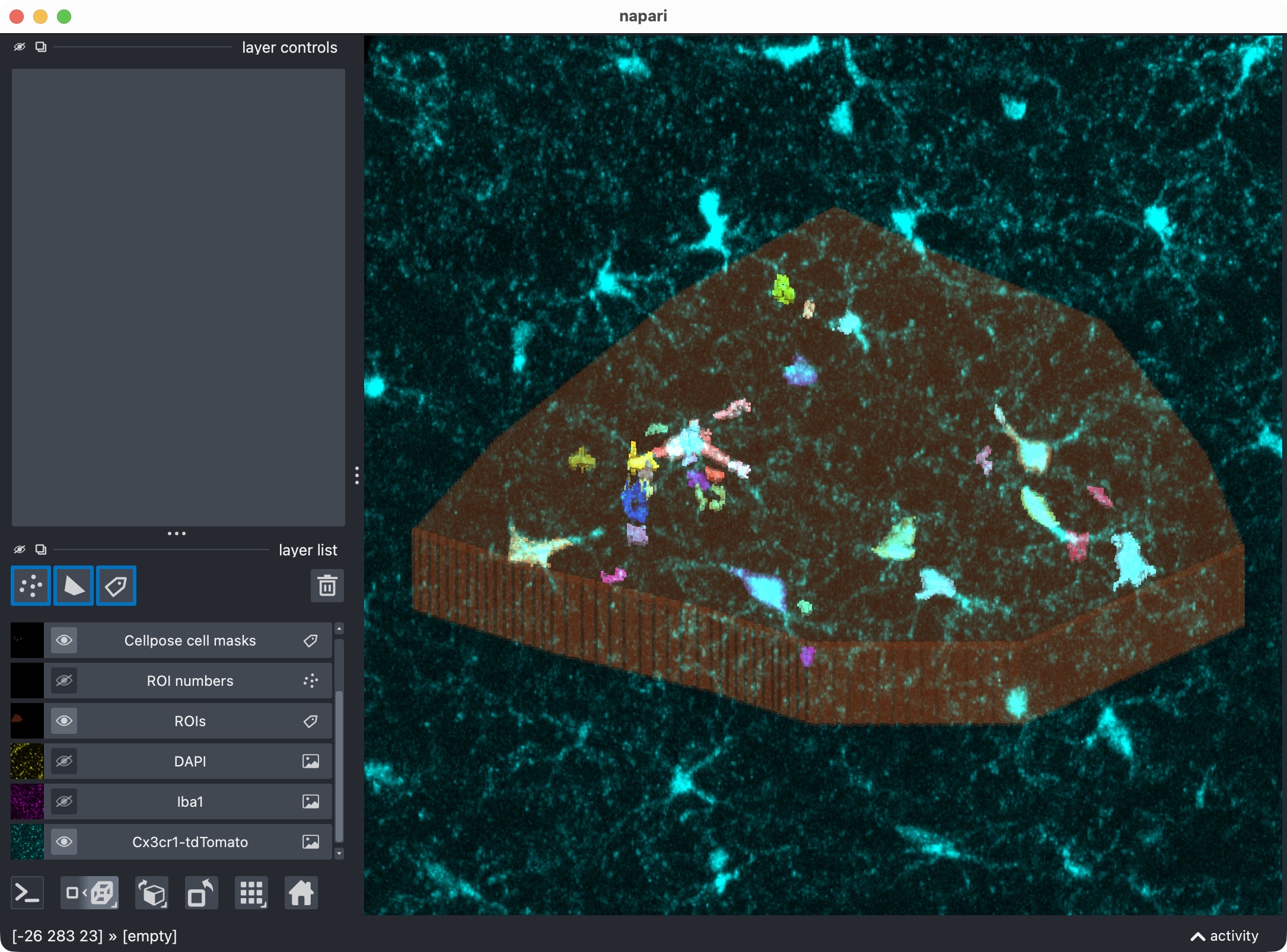 Overlay of raw microglia channel (magenta) and segmented cell mask after refinement, shown in napari.