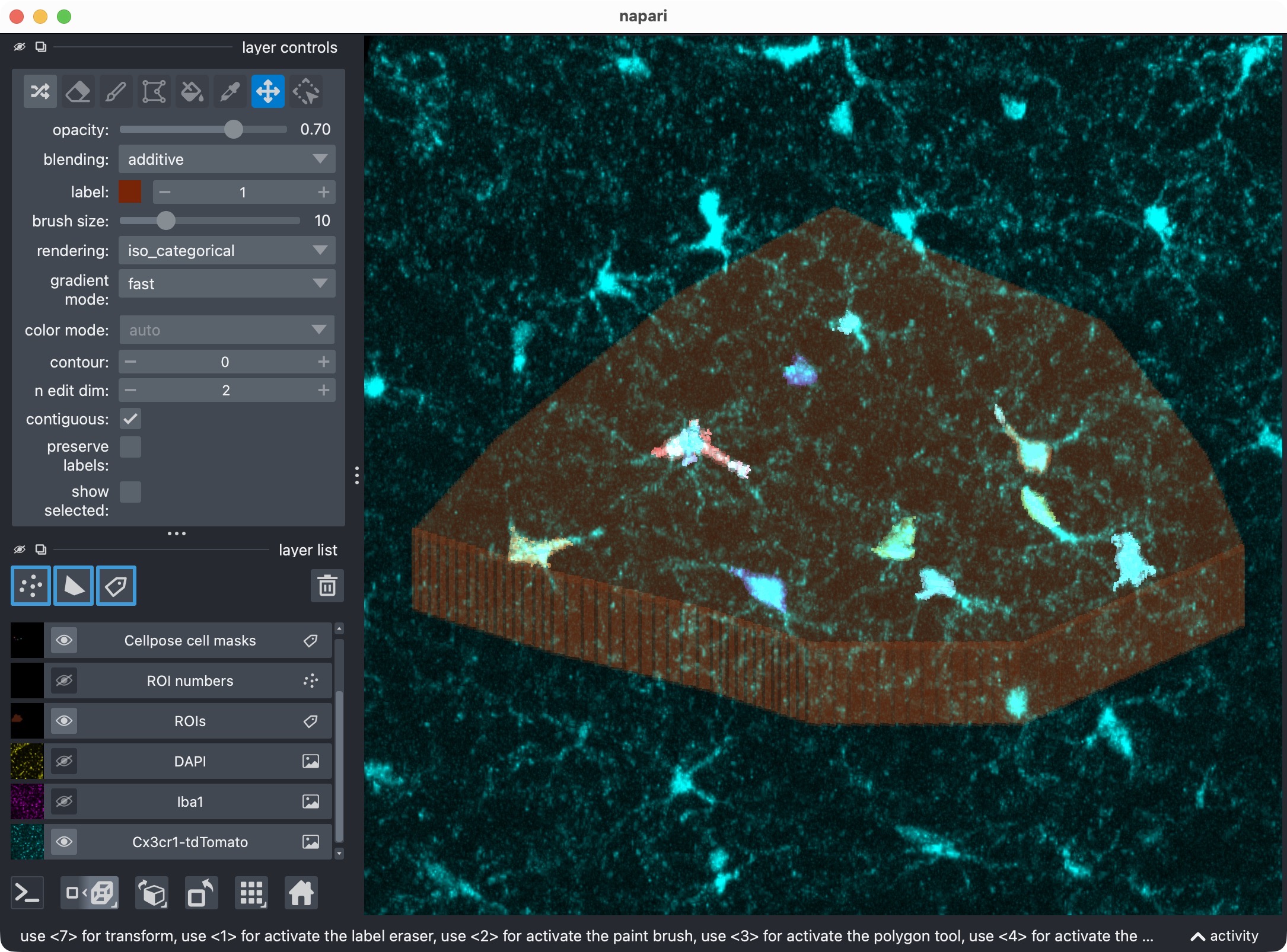 Overlay of raw microglia channel (magenta) and segmented cell mask after refinement, shown in napari.