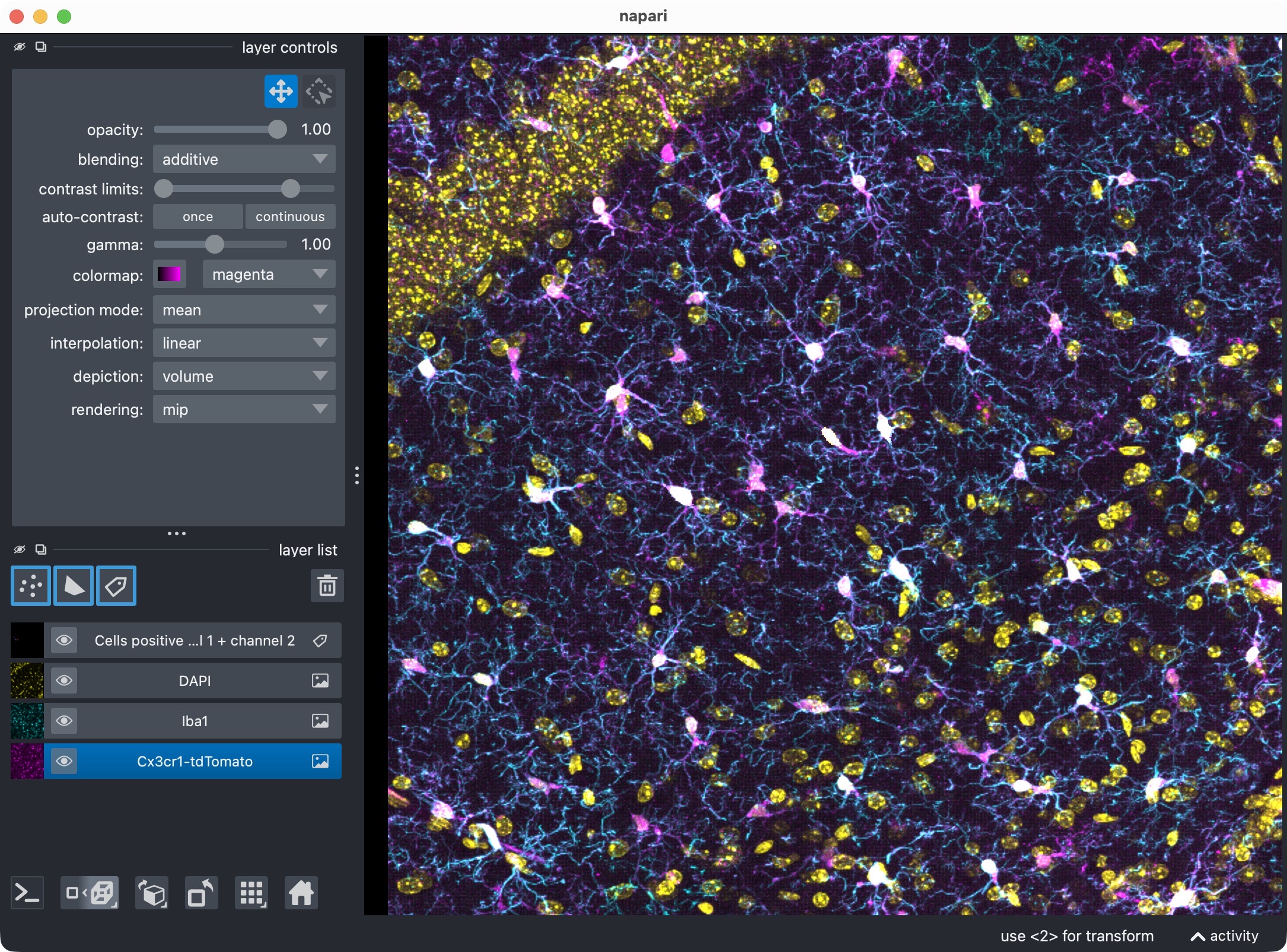 Overview of the microglia (magenta), Iba1 (cyan), and optional third channel (yellow), along with the segmentation layer of the microglia cells that are positive for both marker channels.