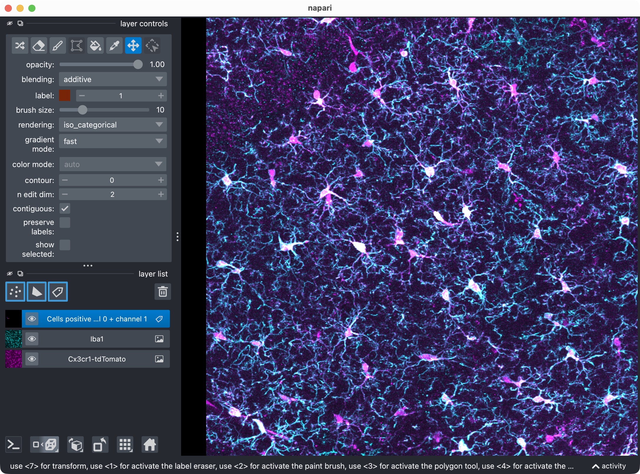 Overview of the microglia and Iba1 channels, showing the microglia channel (magenta) and the Iba1 channel (cyan) in Napari.