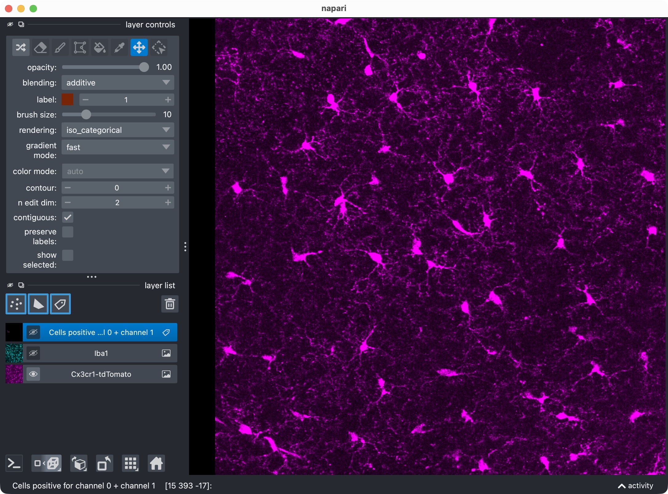 The microglia channel only.
