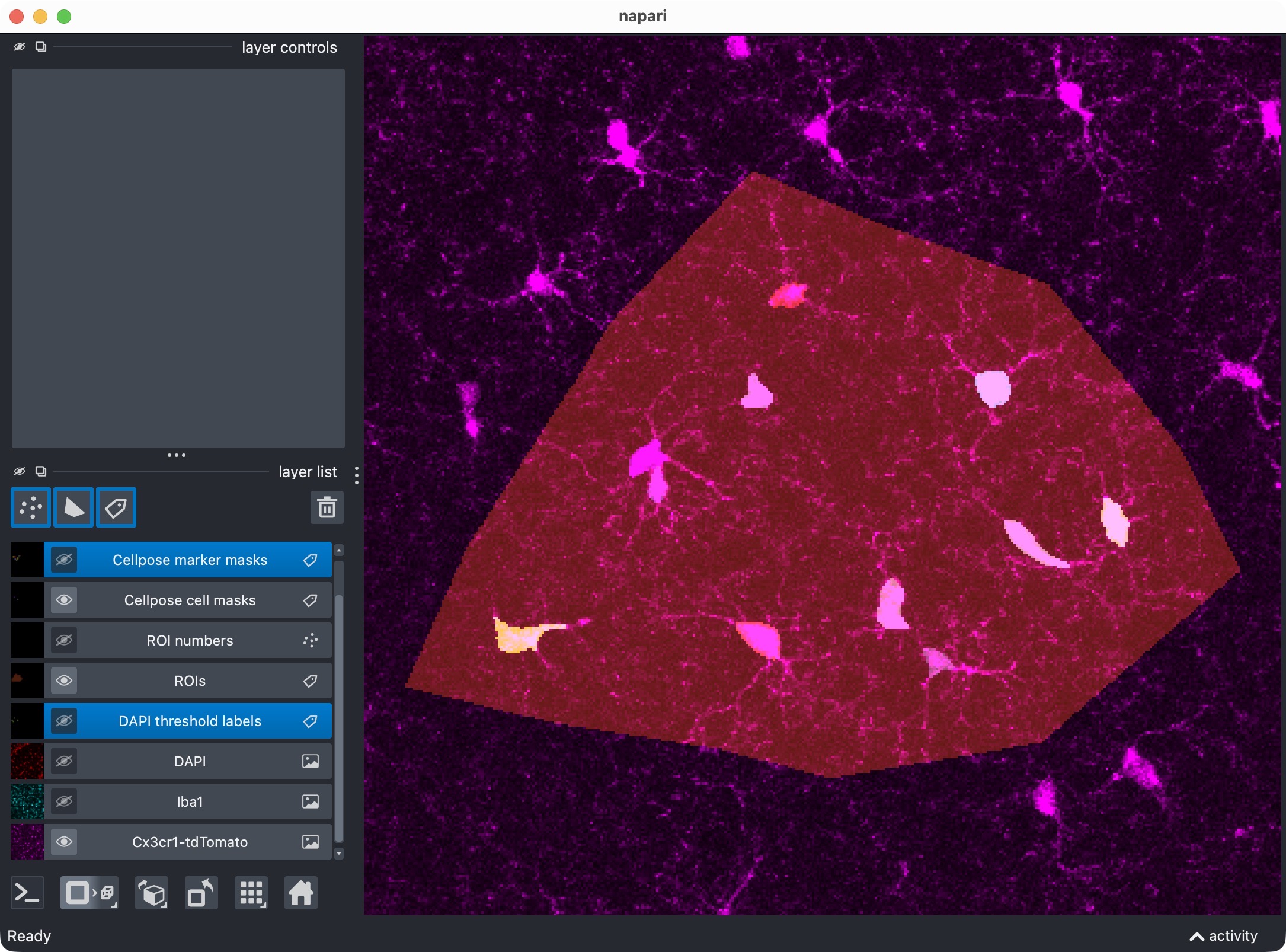 Zoom onto the analyzed ROI, showing the microglia channels and its segmented label layer after refinement.