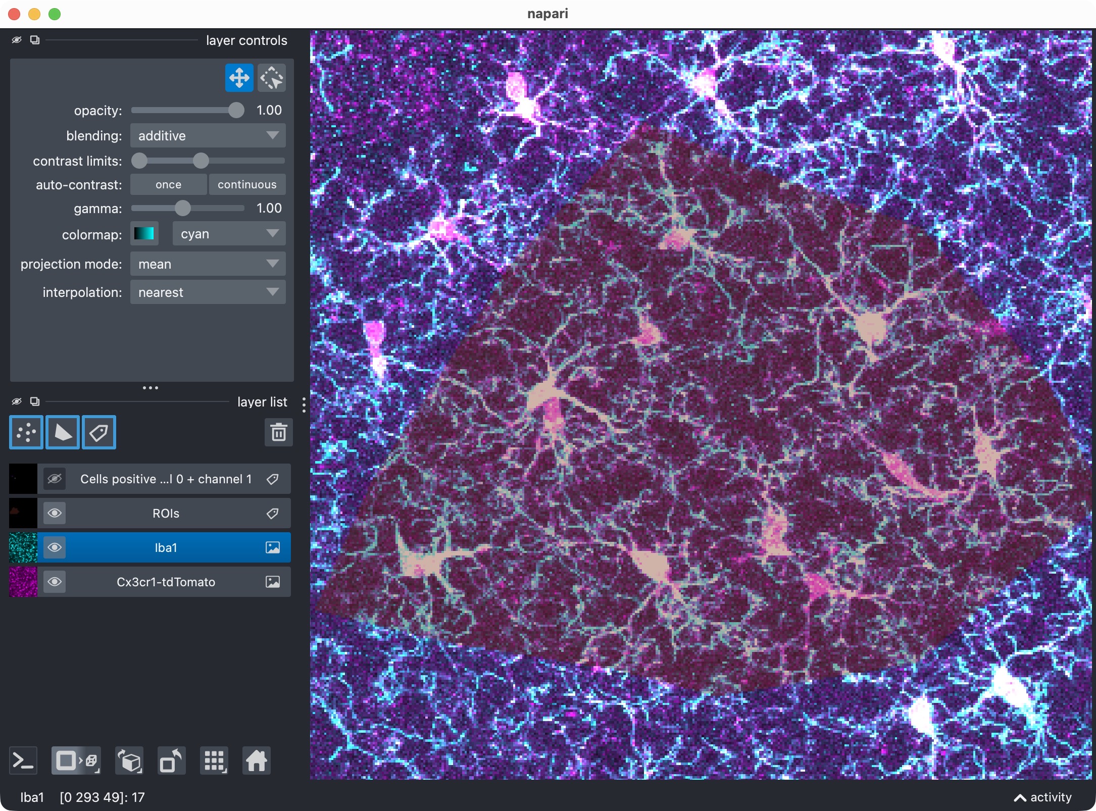 Zoom onto the analyzed ROI, showing the microglia, Iba1, and the resulting segmentation layer of the microglia cells that are positive for Iba1.