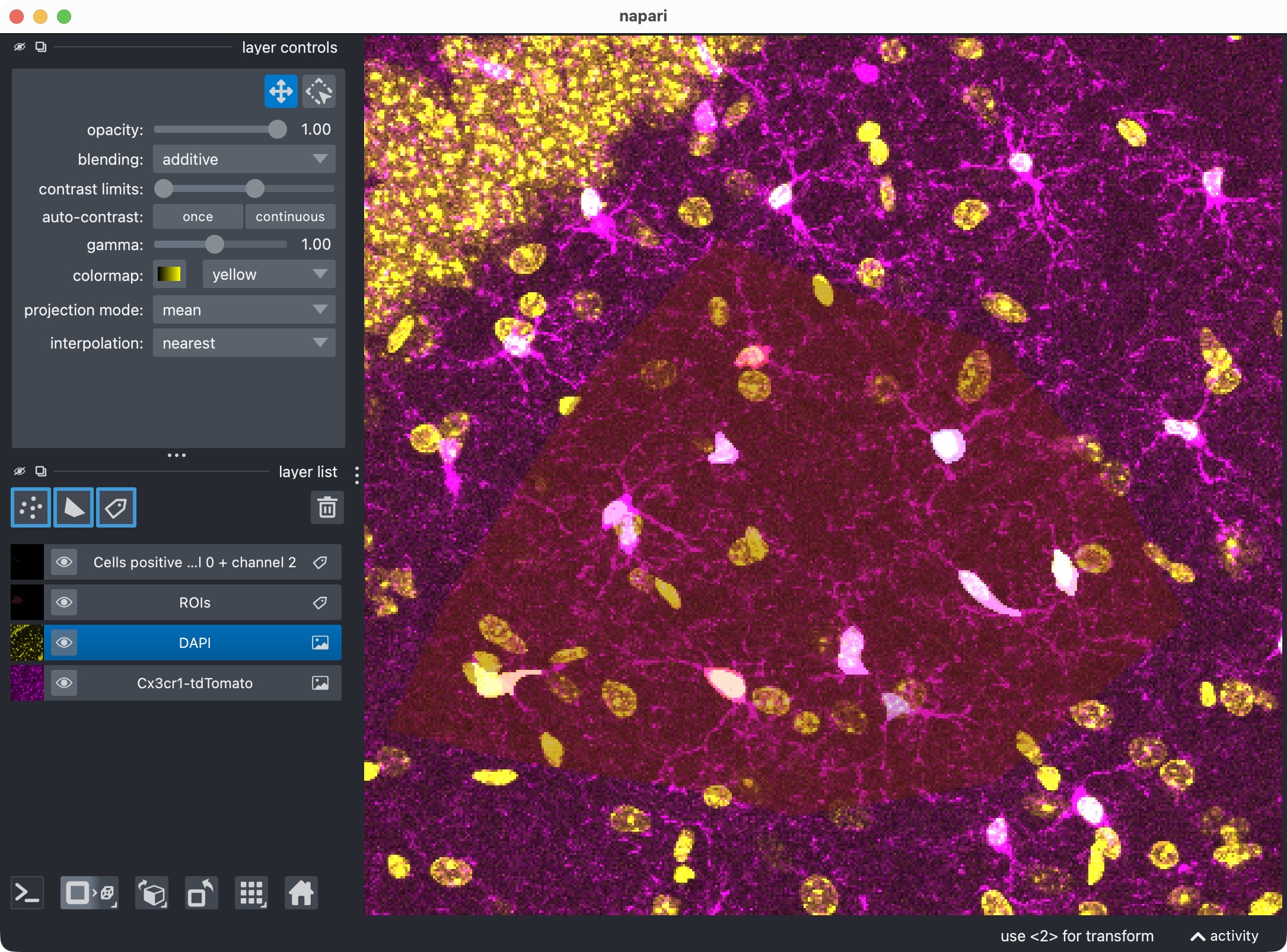 Zoom onto the analyzed ROI, showing the microglia, DAPI, and the resulting segmentation layer of the microglia cells that are positive for DAPI.