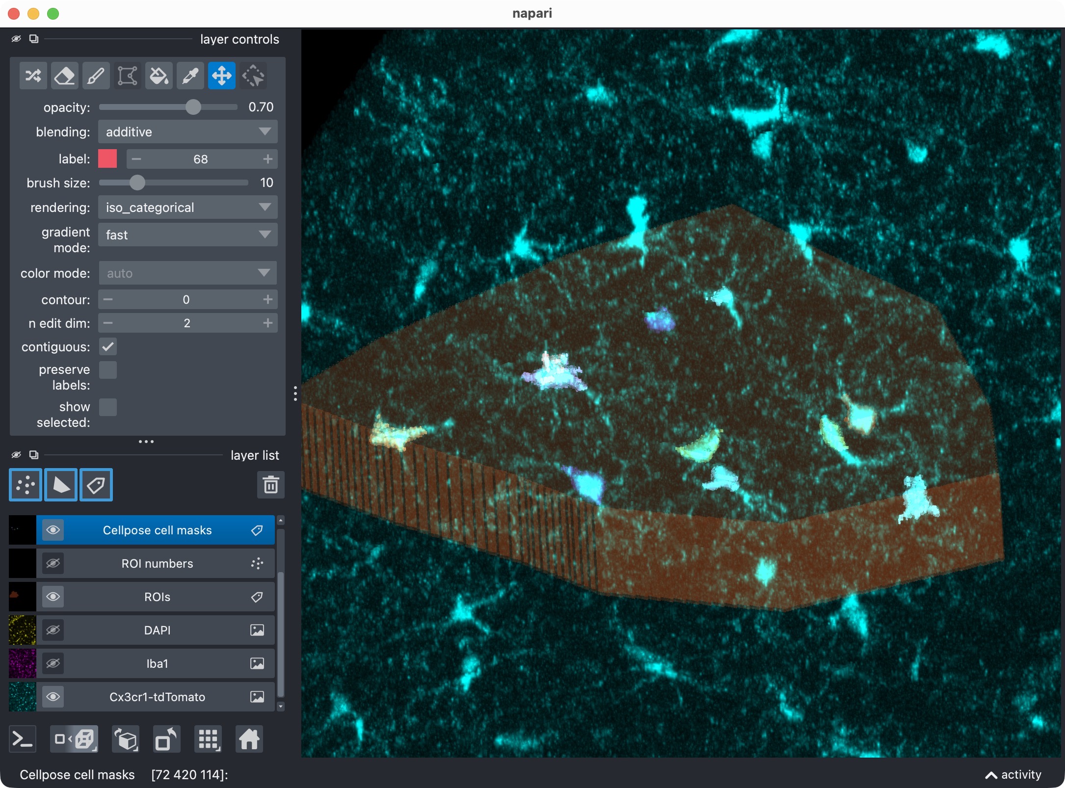 Overlay of raw microglia channel (magenta) and segmented cell mask after refinement, shown in napari.