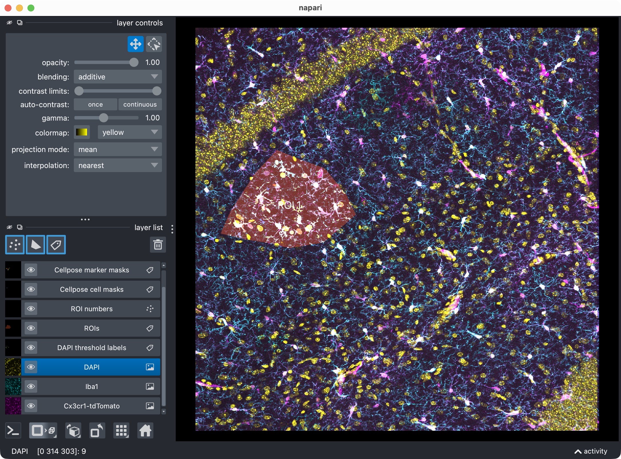 2D-projection of the original 3D stack, showing the microglia (magenta), Iba1 (cyan), and optional third channel (yellow), along with the segmentation layer of the microglia cells that are positive for both marker channels.