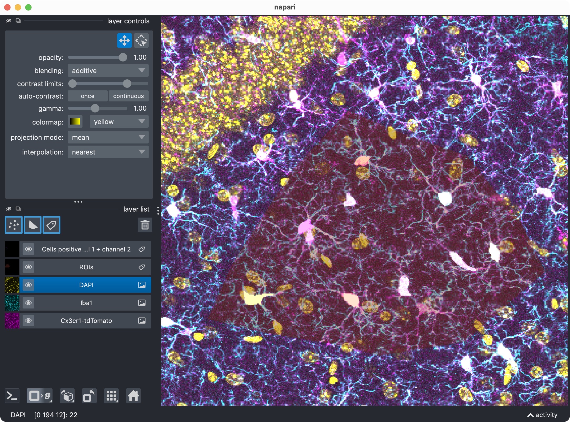 Zoom onto the analyzed ROI, showing the microglia, DAPI, and the resulting segmentation layer of the microglia cells that are positive for DAPI.